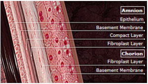 amnion chorion